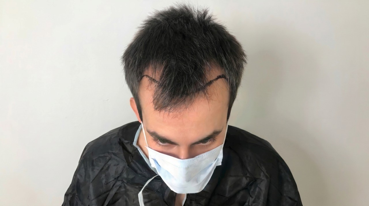 Before